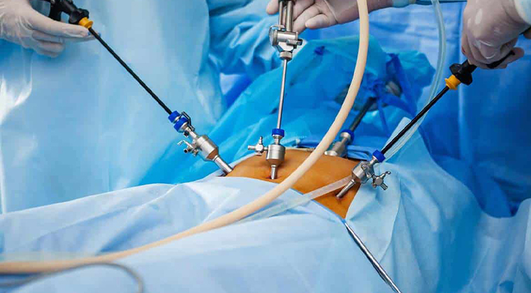 Cirugía Laparoscópica